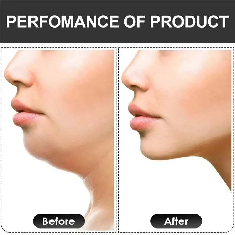 JawFlex™ U-Shape Trainer