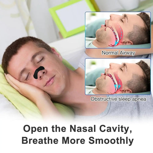 EasyBreathe™ Nose Strips